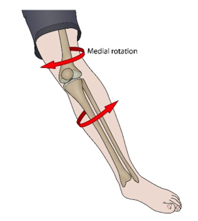 Anterior Cruciate Ligament (ACL) & Medial Collateral Knee Ligament (MCL ...